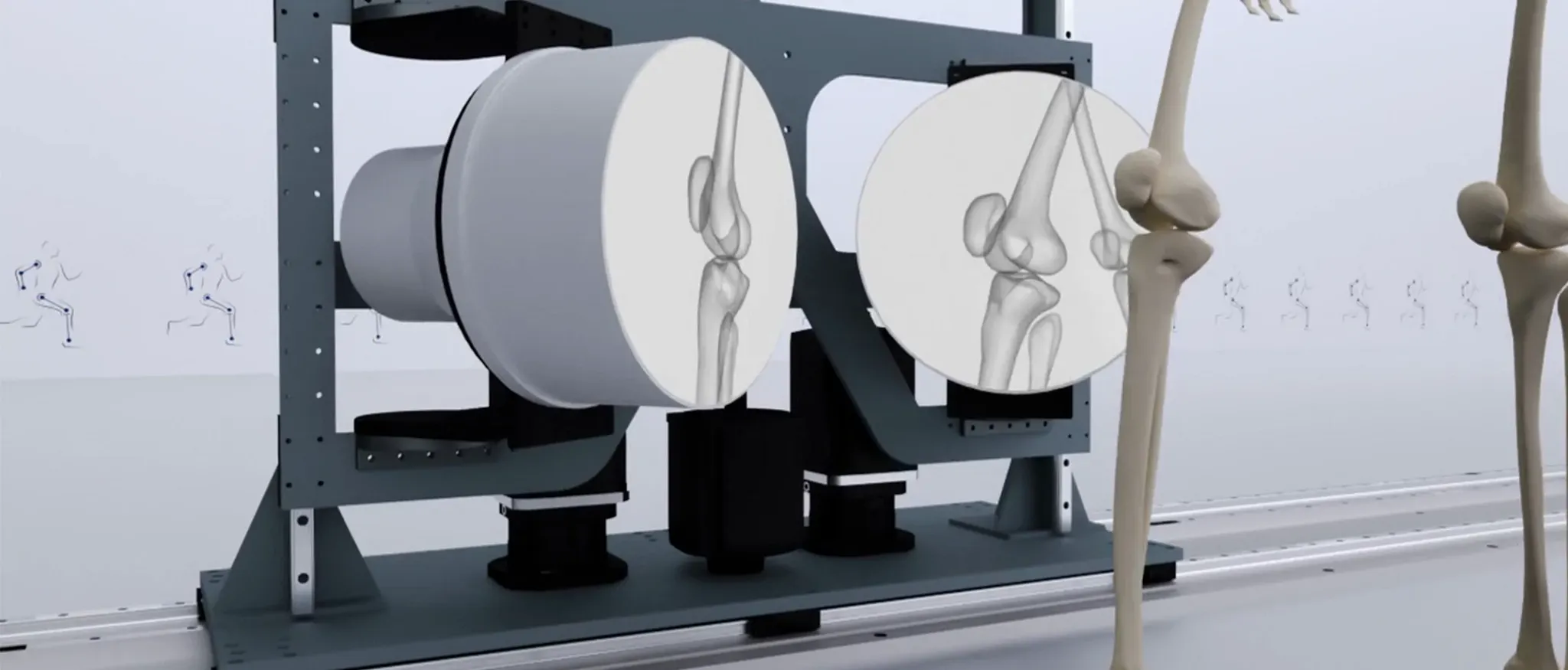 Two-plane fluoroscope of the LMB, detail at the knee