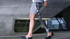 Prostheses