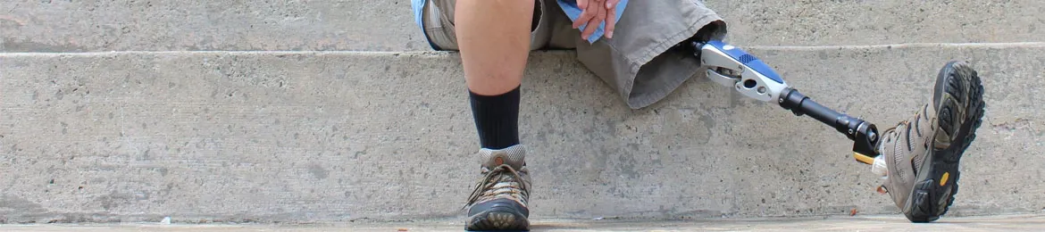 Man with a prosthetic leg